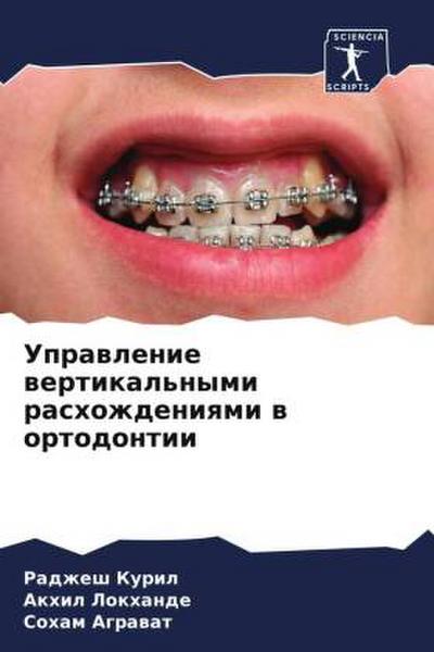 Uprawlenie wertikal’nymi rashozhdeniqmi w ortodontii