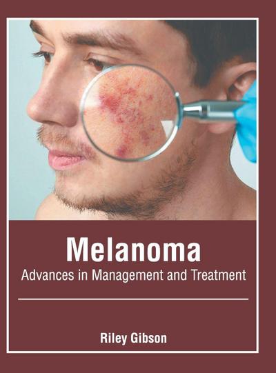 Melanoma: Advances in Management and Treatment