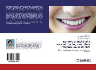 Borders of metal and ceramic copings and their influence on aesthetics