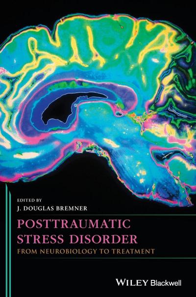Posttraumatic Stress Disorder