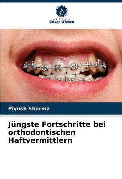 Jüngste Fortschritte bei orthodontischen Haftvermittlern