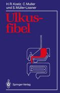 Ulkusfibel