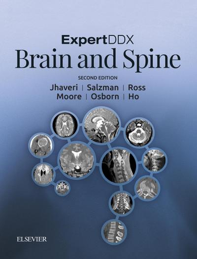 ExpertDDx: Brain and Spine E-Book