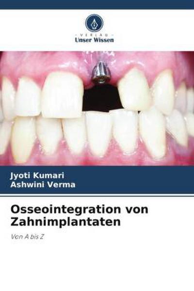 Osseointegration von Zahnimplantaten