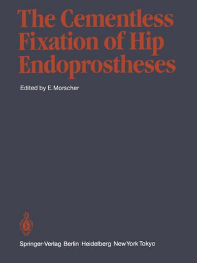 The Cementless Fixation of Hip Endoprostheses