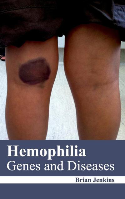 Hemophilia