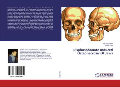 Bisphosphonate Induced Osteonecrosis Of Jaws