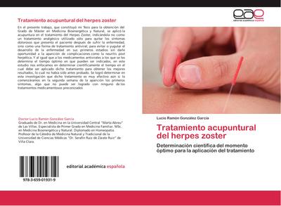 Tratamiento acupuntural del herpes zoster