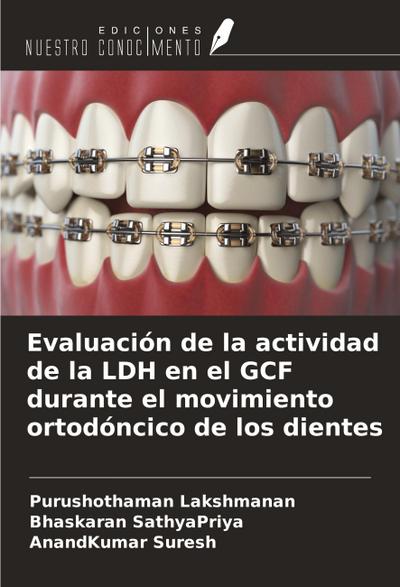 Evaluación de la actividad de la LDH en el GCF durante el movimiento ortodóncico de los dientes