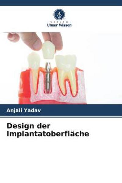 Design der Implantatoberfläche