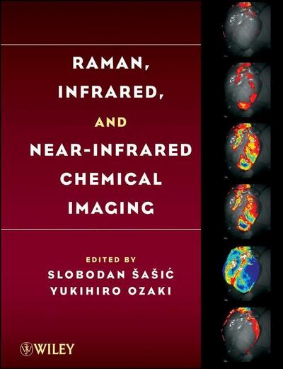 Raman, Infrared, and Near-Infrared Chemical Imaging