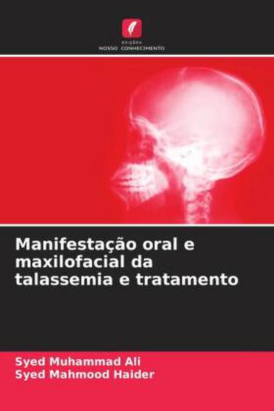 Manifestação oral e maxilofacial da talassemia e tratamento