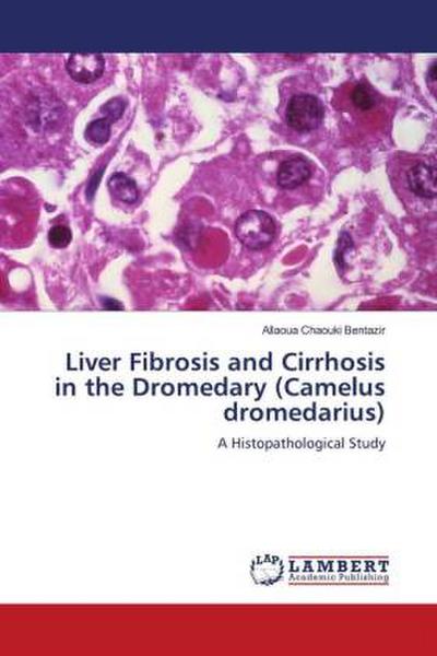 Liver Fibrosis and Cirrhosis in the Dromedary (Camelus dromedarius)