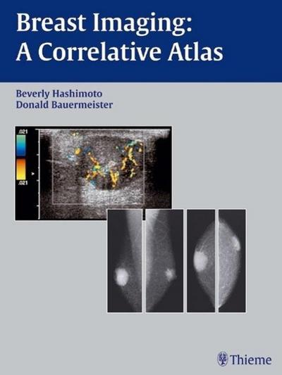 Breast Imaging: A Correlative Atlas