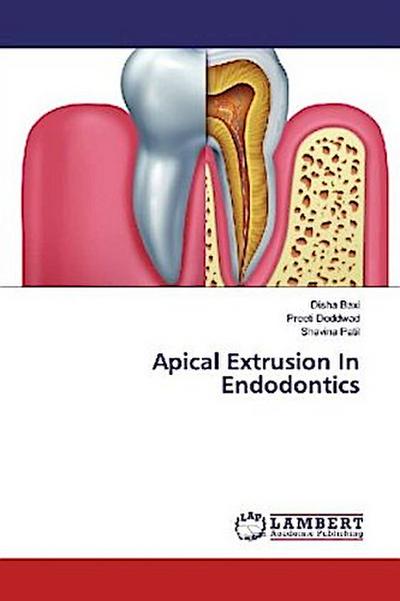 Apical Extrusion In Endodontics