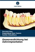 Osseoverdichtung bei Zahnimplantaten