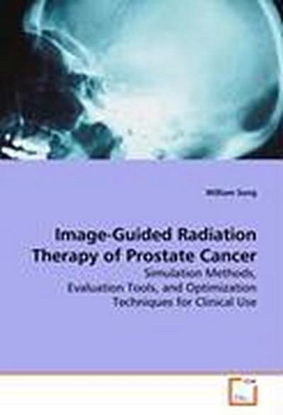 Image-Guided Radiation Therapy of Prostate Cancer