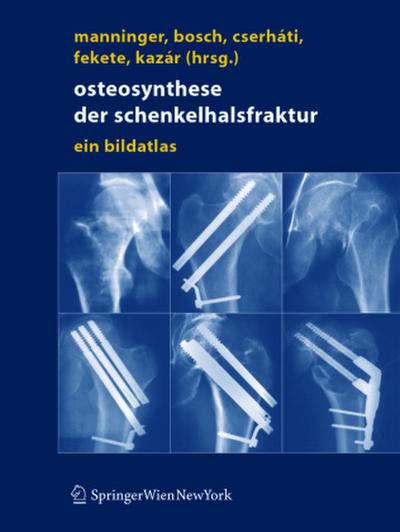 Osteosynthese der Schenkelhalsfraktur