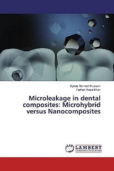 Microleakage in dental composites: Microhybrid versus Nanocomposites