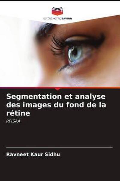 Segmentation et analyse des images du fond de la rétine