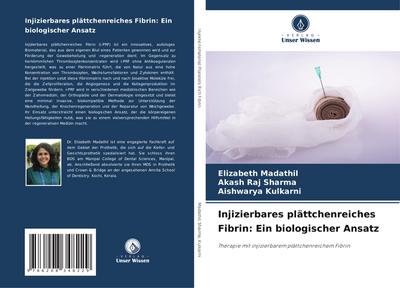 Injizierbares plättchenreiches Fibrin: Ein biologischer Ansatz