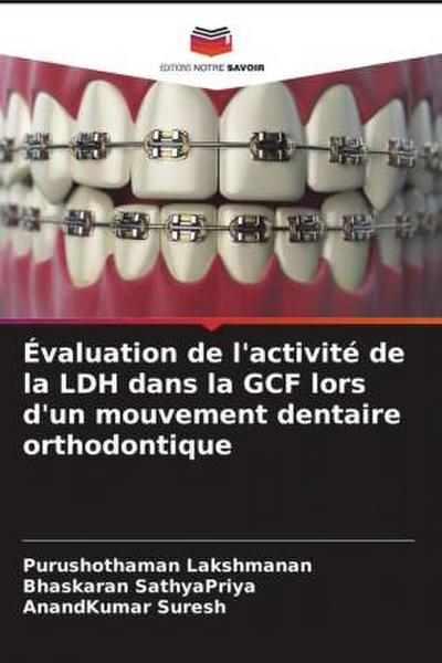 Évaluation de l’activité de la LDH dans la GCF lors d’un mouvement dentaire orthodontique