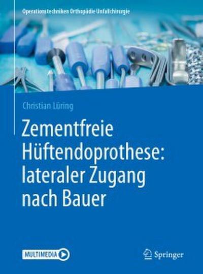 Zementfreie Hüftendoprothese: lateraler Zugang nach Bauer