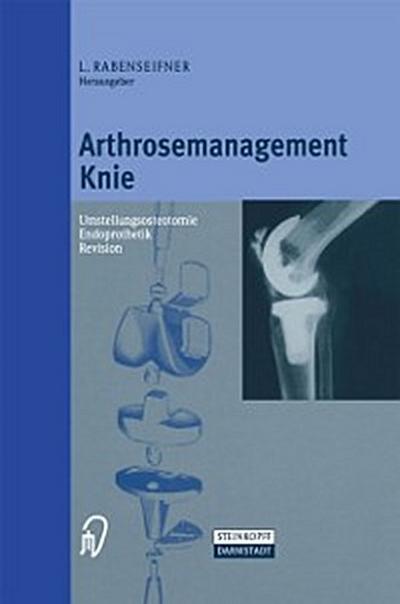 Arthrosemanagement Knie