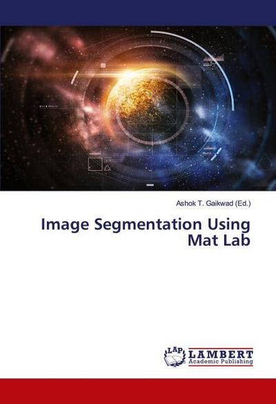 Image Segmentation Using Mat Lab