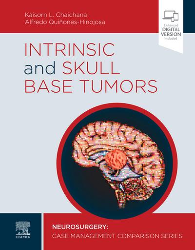 Intrinsic and Skull Base Tumors