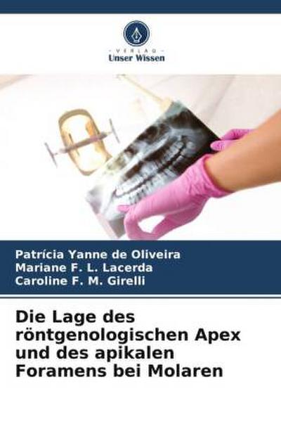 Die Lage des röntgenologischen Apex und des apikalen Foramens bei Molaren