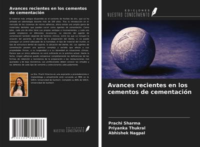 Avances recientes en los cementos de cementación