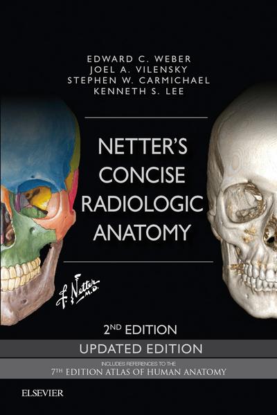 Netter’s Concise Radiologic Anatomy Updated Edition E-Book