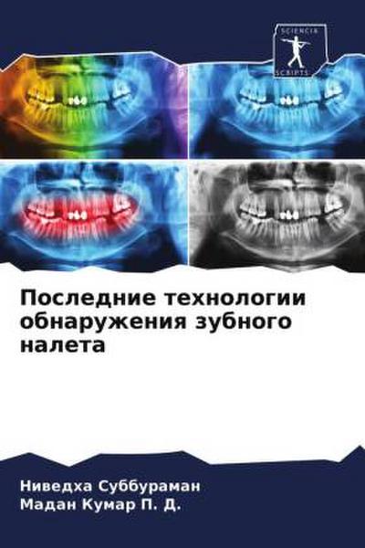 Poslednie tehnologii obnaruzheniq zubnogo naleta