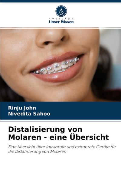 Distalisierung von Molaren - eine Übersicht