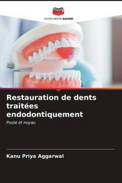 Restauration de dents traitées endodontiquement