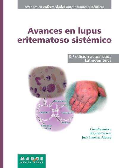 Avances en lupus eritematoso sistémico - Latinoamérica