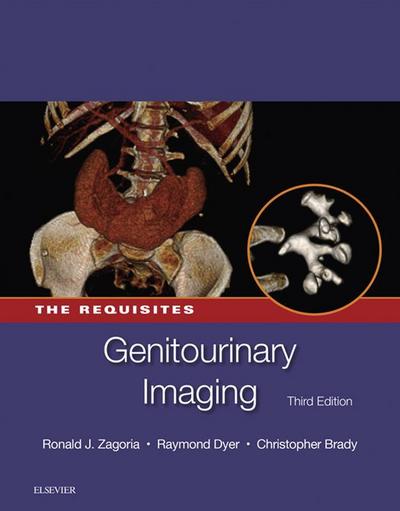Genitourinary Imaging: The Requisites E-Book