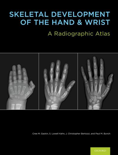 Skeletal Development of the Hand and Wrist