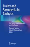Frailty and Sarcopenia in Cirrhosis