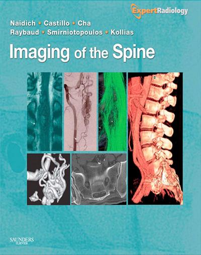 Imaging of the Spine E-Book