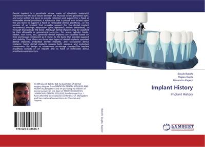 Implant History