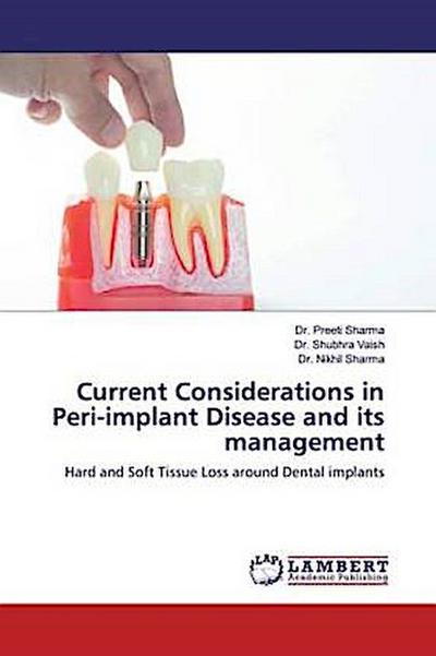 Current Considerations in Peri-implant Disease and its management