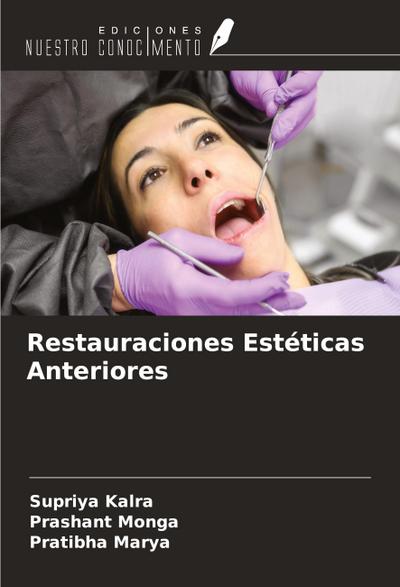 Restauraciones Estéticas Anteriores