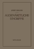 Augenärztliche Eingriffe