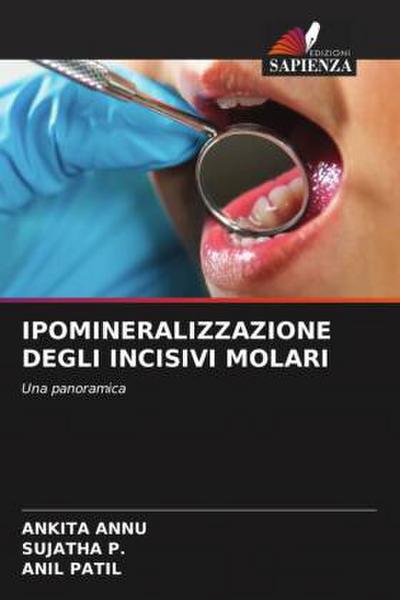 IPOMINERALIZZAZIONE DEGLI INCISIVI MOLARI