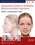 Illustrated Guide to Aesthetic Botulinumtoxin Inje