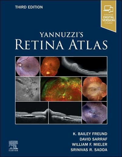 Yannuzzi’s Retina Atlas