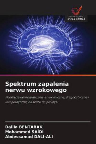 Spektrum zapalenia nerwu wzrokowego