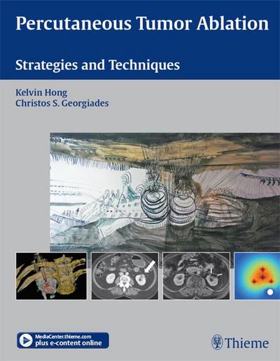 Percutaneous Tumor Ablation